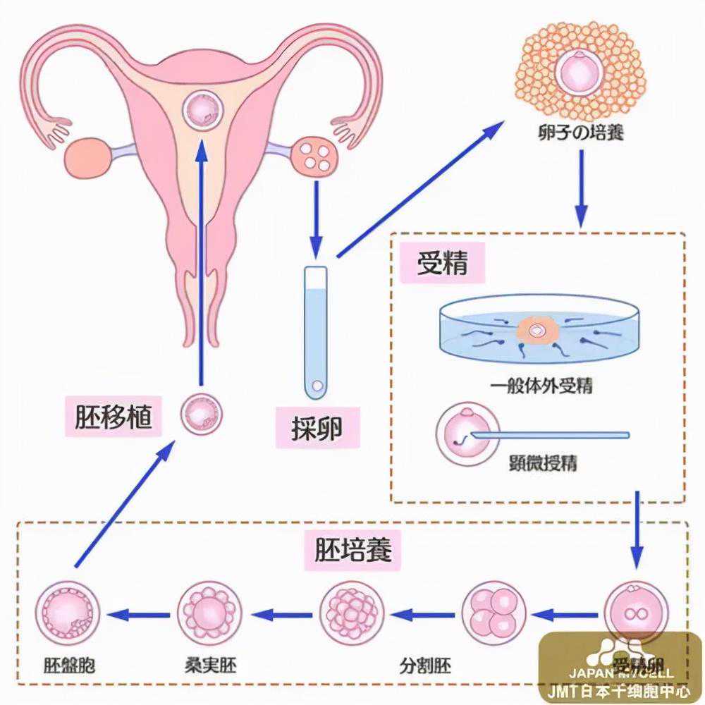 香港验血男女价格是多少,苏州显微外科取精后辅助生殖助孕获成功